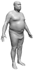 BMI 40 - 极度肥胖