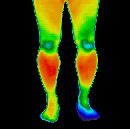 Thermogram of legs
