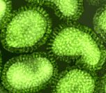 electron photomicrograph of influenza virus